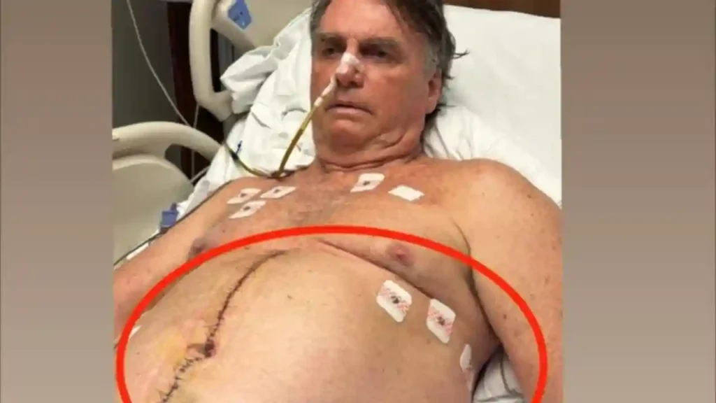 Silas Malafaia convoca 7 dias de jejum e oração por Jair Bolsonaro